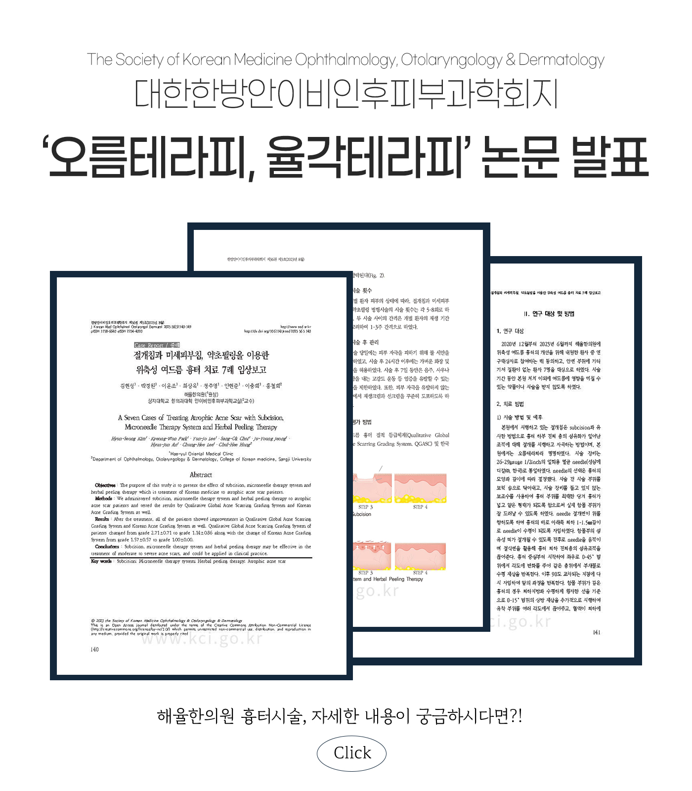 흉터 논문발표