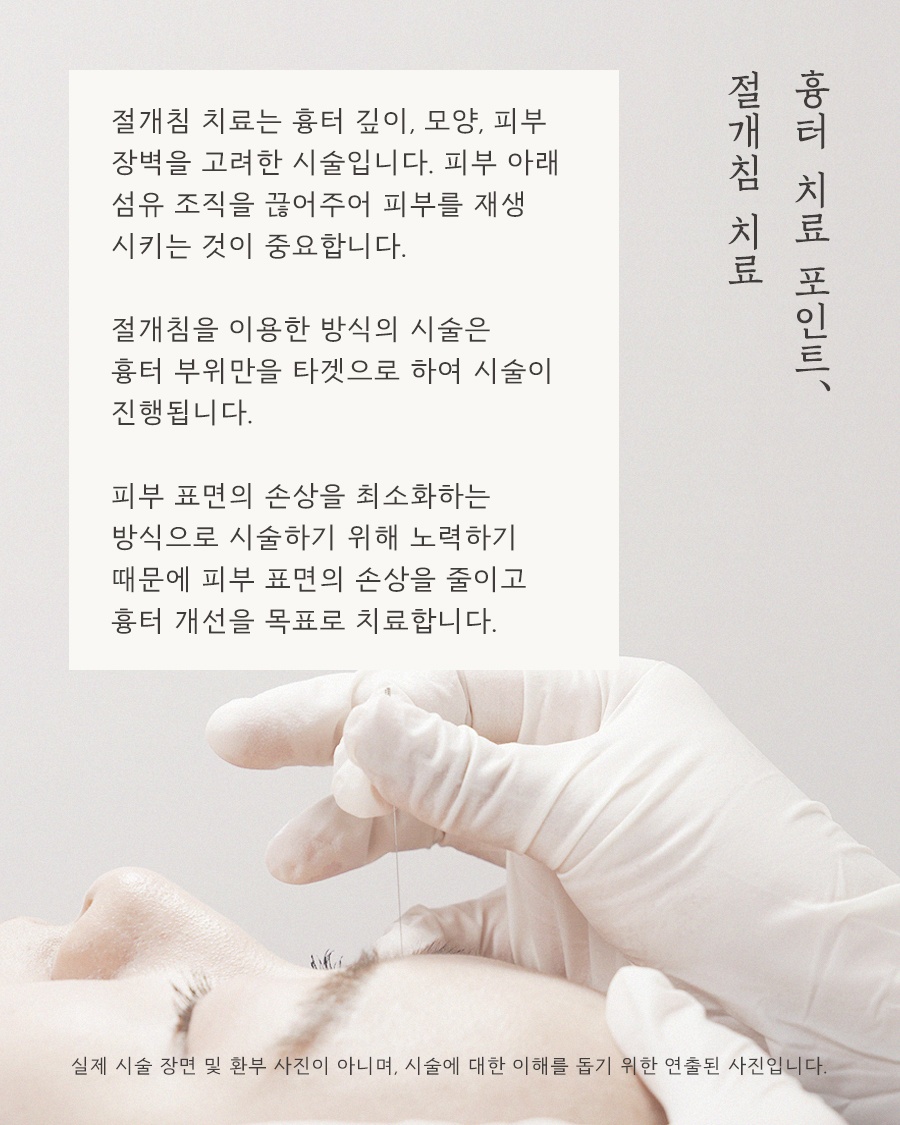 [노원점] 노원여드름흉터 치료 시기를 고민하고 있다면? - 해율한의원