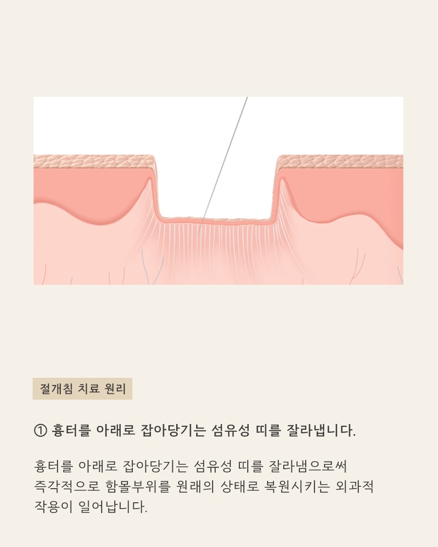 [노원점] 노원여드름흉터 치료 시기를 고민하고 있다면? - 해율한의원