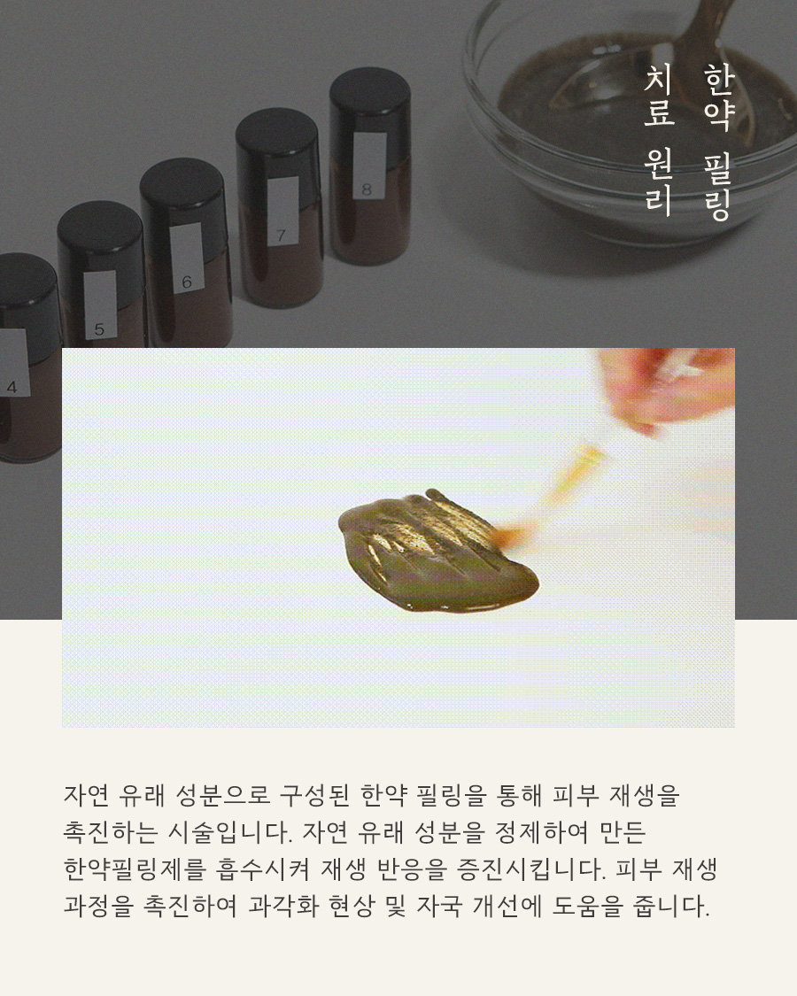 [목동점] 목동모공각화증은 어떻게 치료하나요? - 해율한의원
