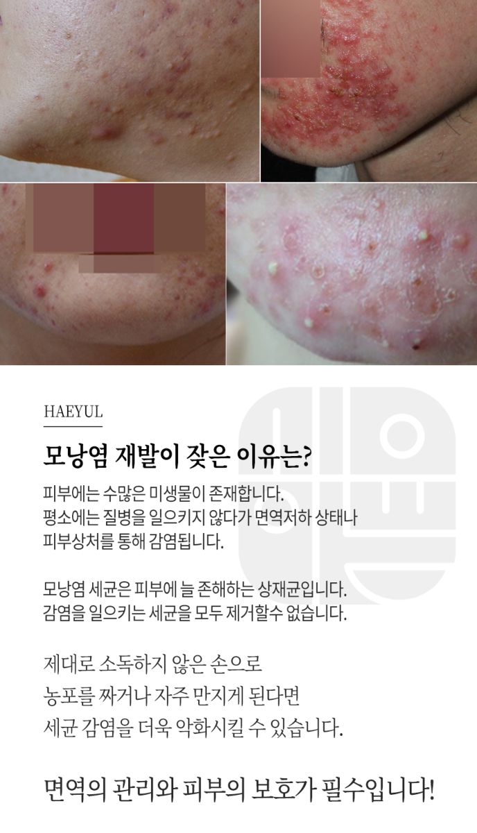 [노원점] 모낭염 재발 원인, 치료에 대해 노원 해율한의원에서 설명드립니다 - 해율한의원