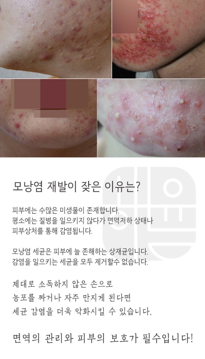 [분당점] 분당모낭염 압출하면 안되는 이유, 원장님이 설명드립니다 - 해율한의원