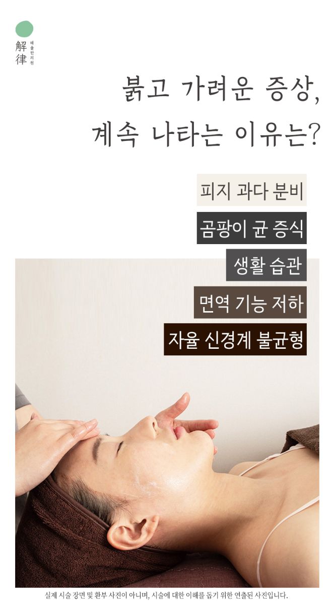 [대구점] 대구지루피부염, 주사피부염과 어떻게 다른가요? - 해율한의원