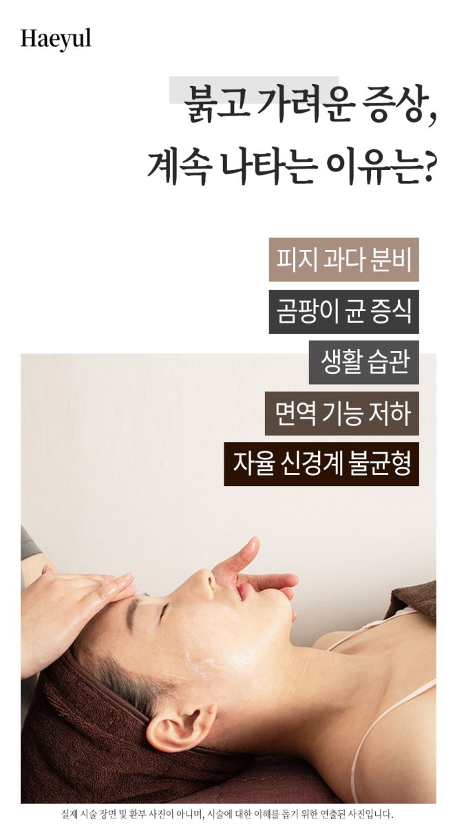 [분당점] 지루성피부염 붉고 가려운 이유, 치료까지 분당 해율한의원이 설명드립니다 - 해율한의원