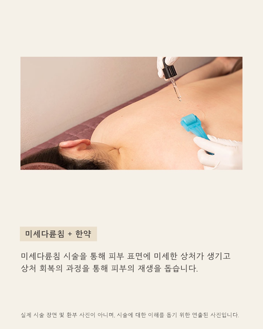 [수원점] 수원등여드름 어느 순간 넓게 번지고 있다면 원인 설명드립니다 - 해율한의원