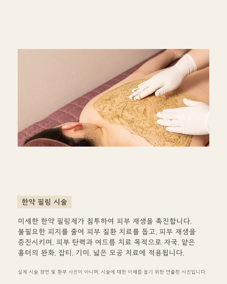 [수원점] 수원등여드름 어느 순간 넓게 번지고 있다면 원인 설명드립니다 - 해율한의원