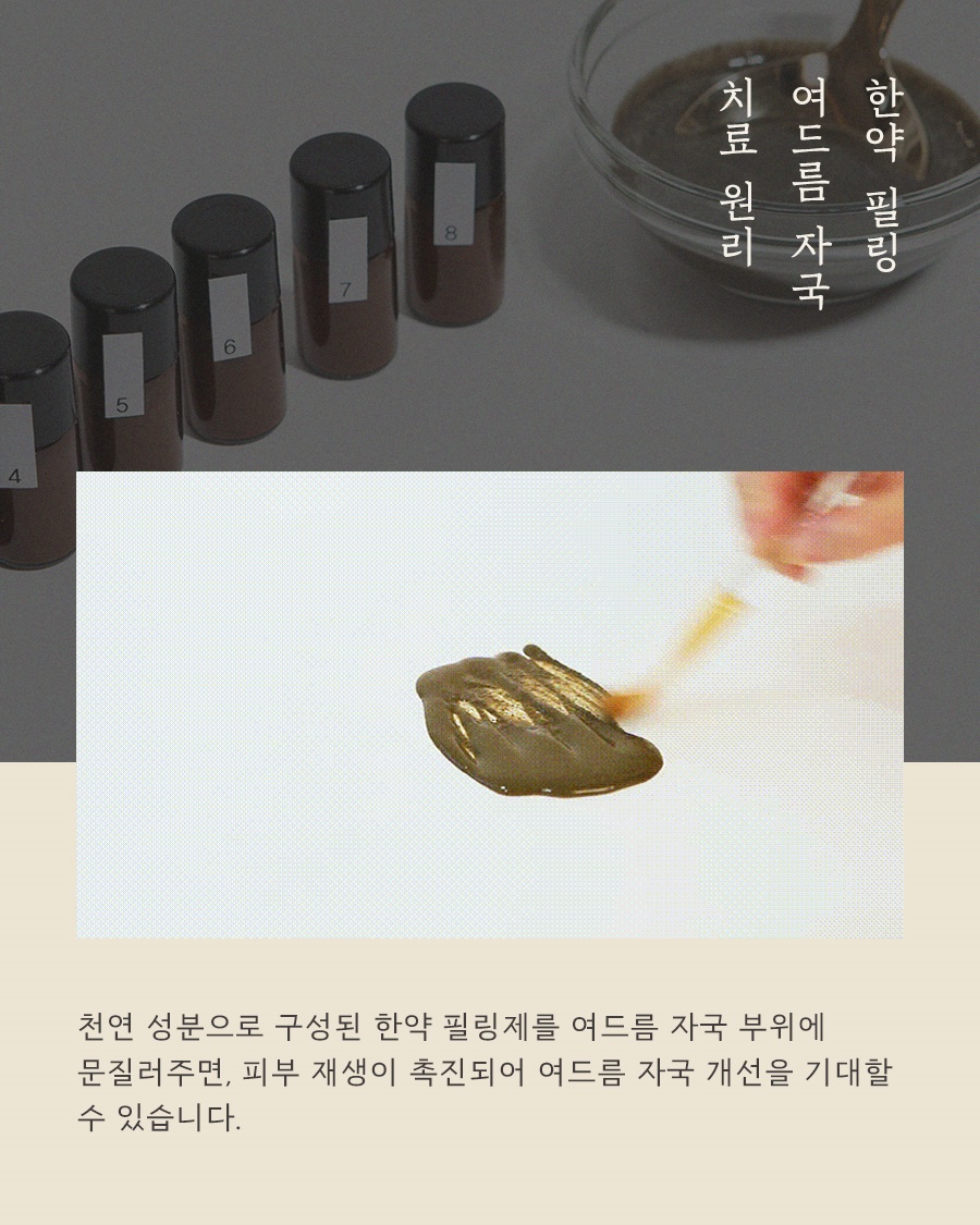 [안산점] 안산여드름자국 흉터랑 다른가요? 구분 및 예방법 - 해율한의원