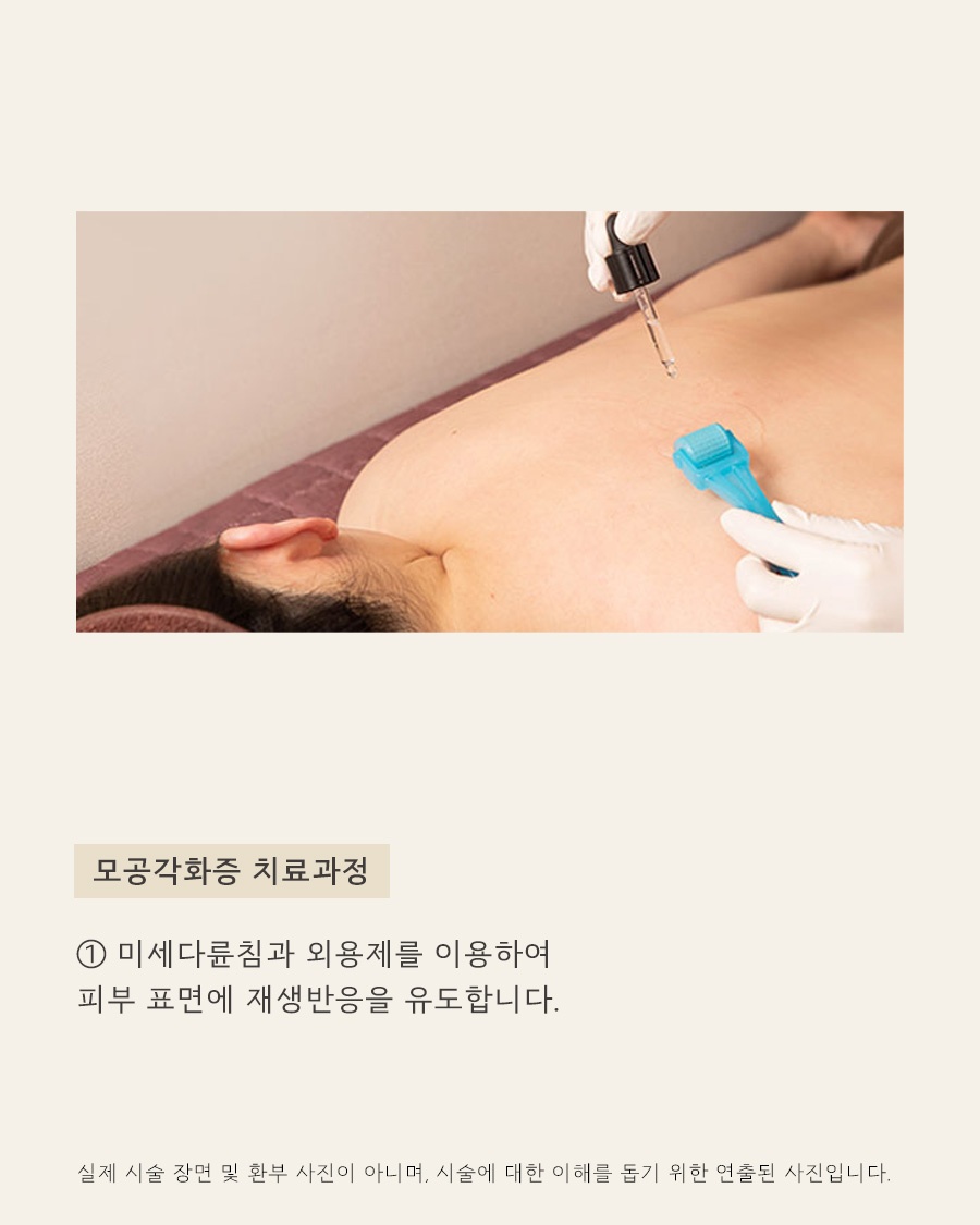 [안양점] 안양모공각화증 자꾸 만져지는 오돌토돌한 피부 고민, 원장님이 설명드립니다 - 해율한의원