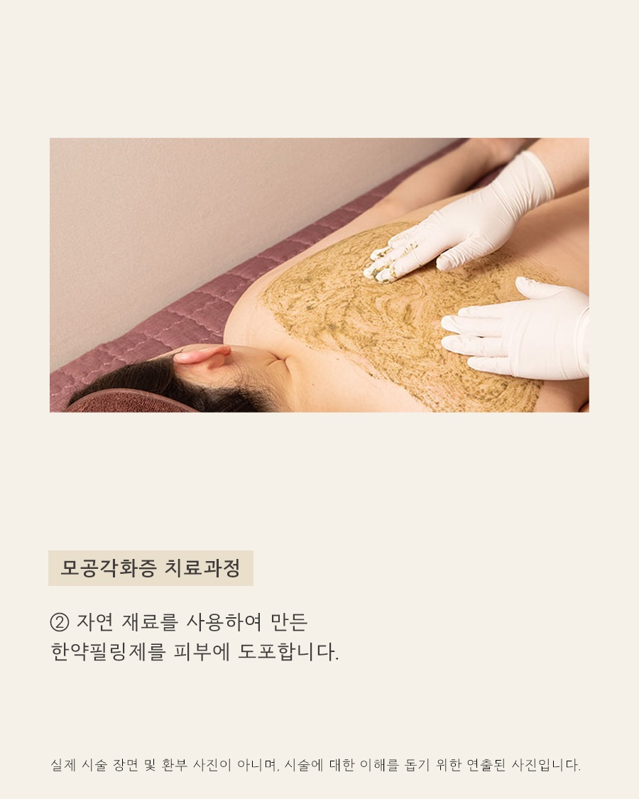 [안양점] 안양모공각화증 자꾸 만져지는 오돌토돌한 피부 고민, 원장님이 설명드립니다 - 해율한의원