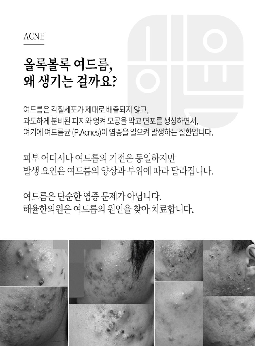 [창원점] 창원피부한의원 갑자기 얼굴이 뒤집어지는 이유는? - 해율한의원
