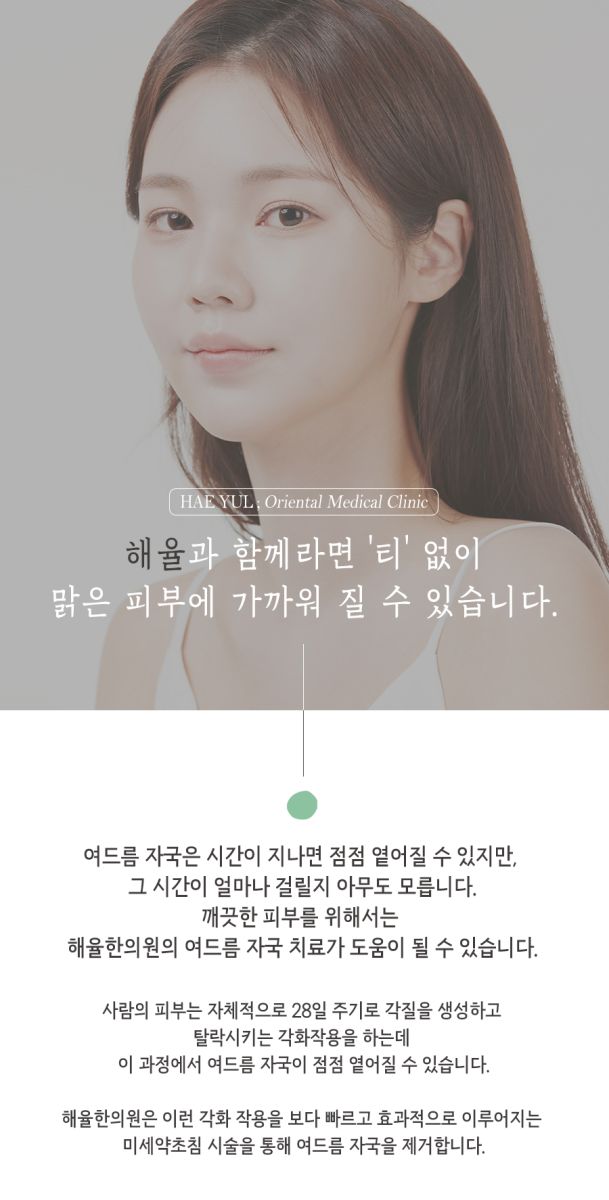 [천안점] 천안여드름자국 미세약초침 원리 및 효과에 대해 설명드립니다 - 해율한의원