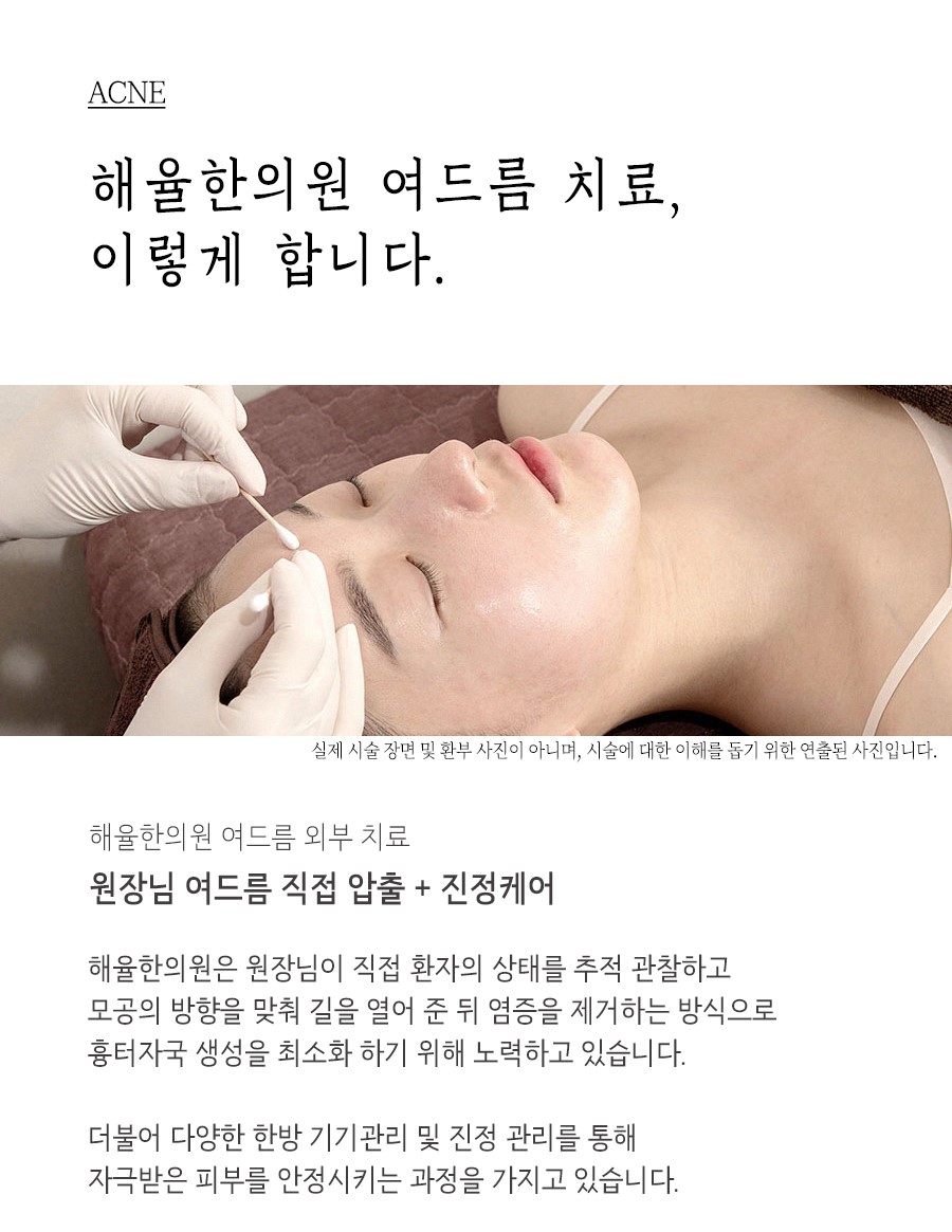 [대구점] 대구여드름한의원 반복되는 여드름, 어떻게 치료해야 할까? - 해율한의원