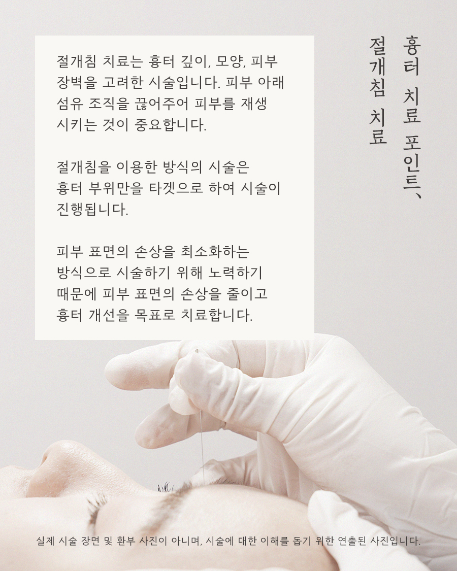 [목동점] 여드름 흉터가 반복되는 내부적·외부적 원인은 무엇인가요? - 해율한의원
