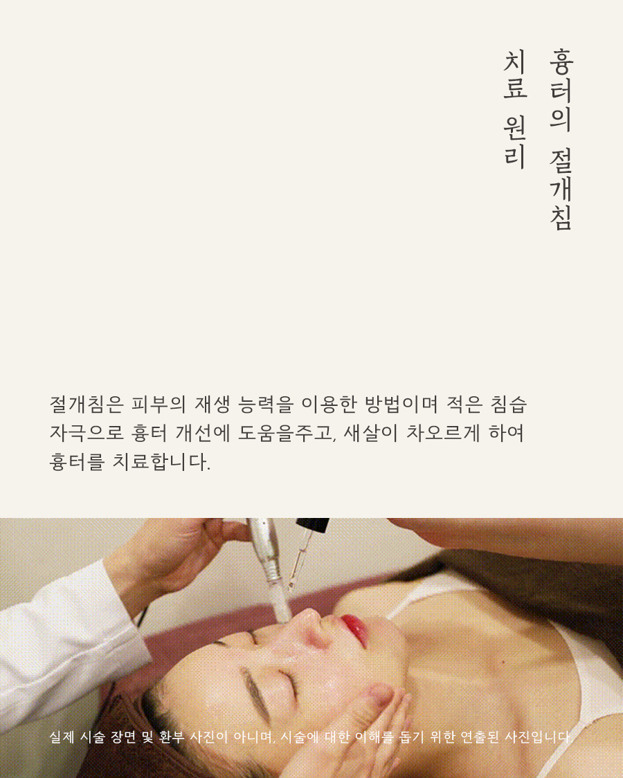 [목동점] 목동여드름흉터는 왜 생기게 되나요? - 해율한의원