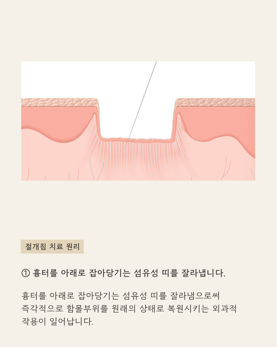 [목동점] 목동여드름 흉터 왜 생길까요? - 해율한의원