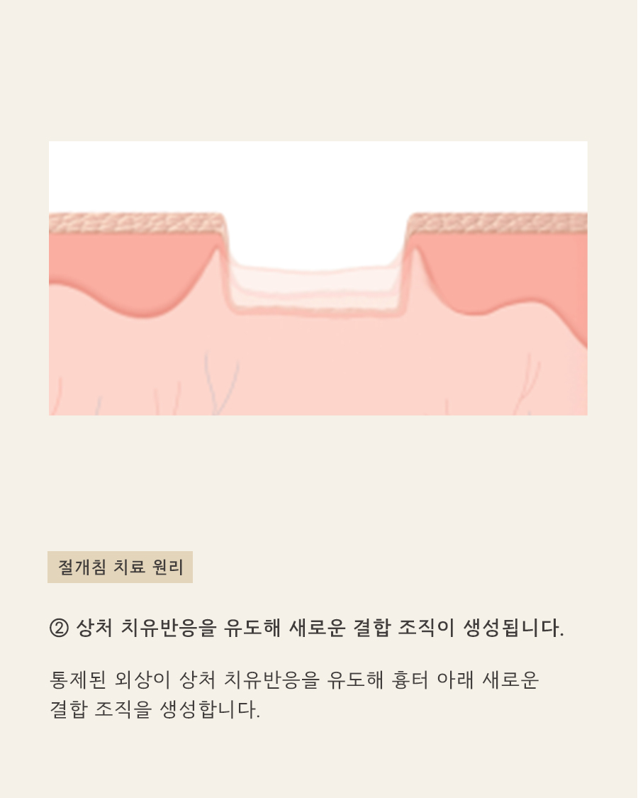 [목동점] 여드름 흉터가 반복되는 내부적·외부적 원인은 무엇인가요? - 해율한의원