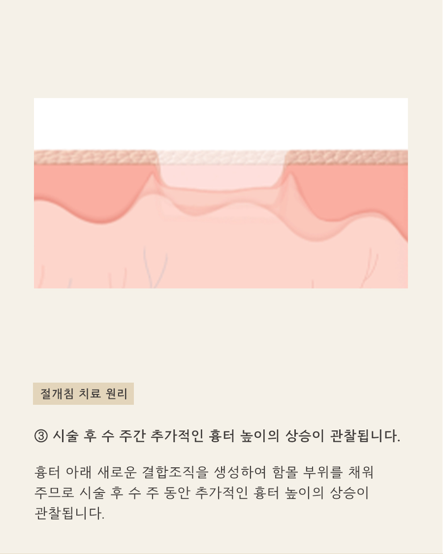 [목동점] 여드름 흉터가 반복되는 내부적·외부적 원인은 무엇인가요? - 해율한의원