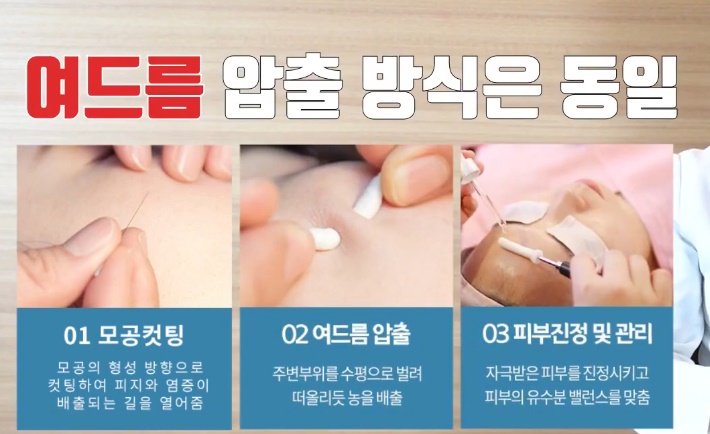 [울산점] 울산여드름한의원 좁쌀여드름 치료 방법 - 해율한의원