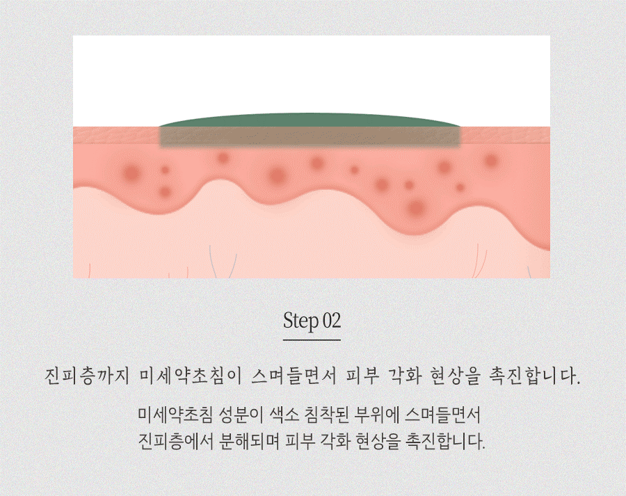 [안산점] 안산여드름자국 오래 남는 이유와 관리법, 원장님이 설명드립니다 - 해율한의원