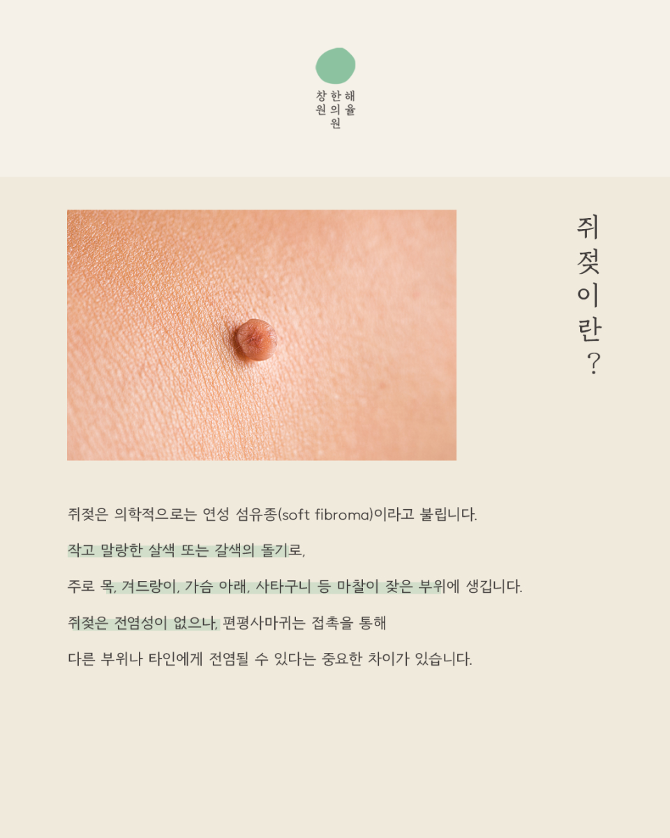 [창원점] 창원편평사마귀 제거 후 딱지와 붉은기는 어떻게 관리할까? - 해율한의원
