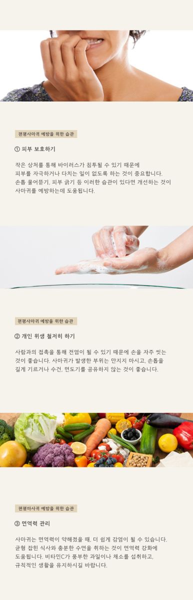 [창원점] 창원편평사마귀 제거 후 딱지와 붉은기는 어떻게 관리할까? - 해율한의원