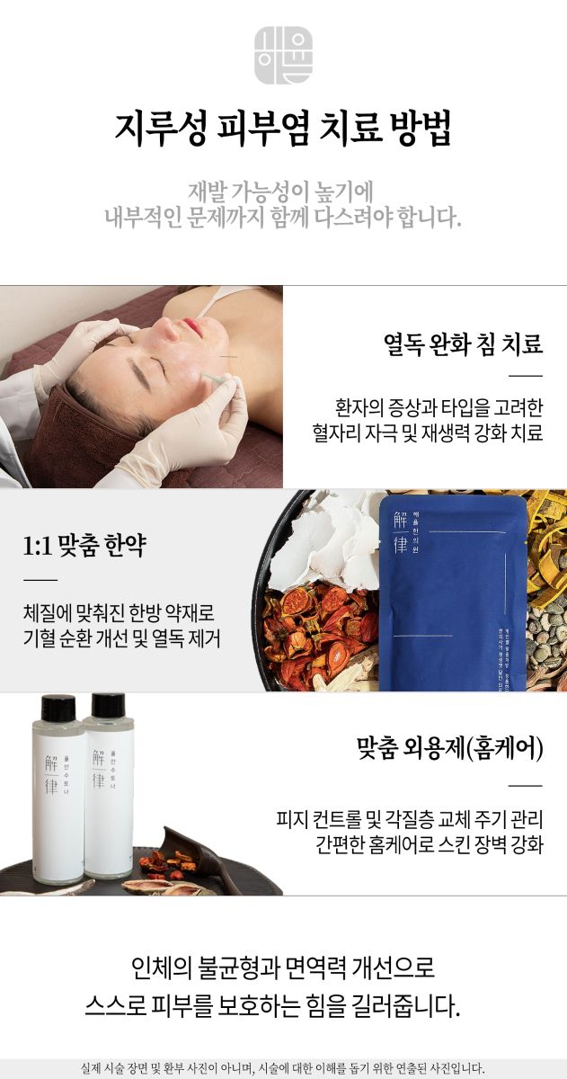 [분당점] 지루성피부염 붉고 가려운 이유, 치료까지 분당 해율한의원이 설명드립니다 - 해율한의원