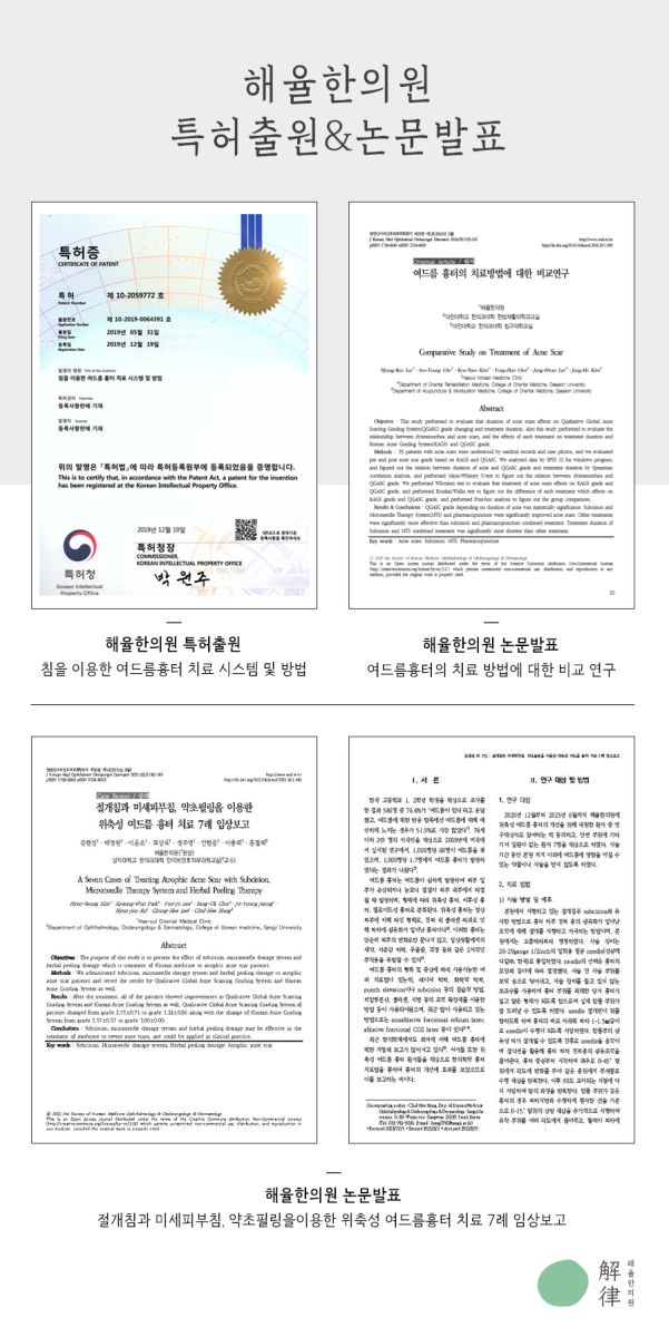 [대구점] 대구새살침 부작용이나 주의사항이 있나요? - 해율한의원