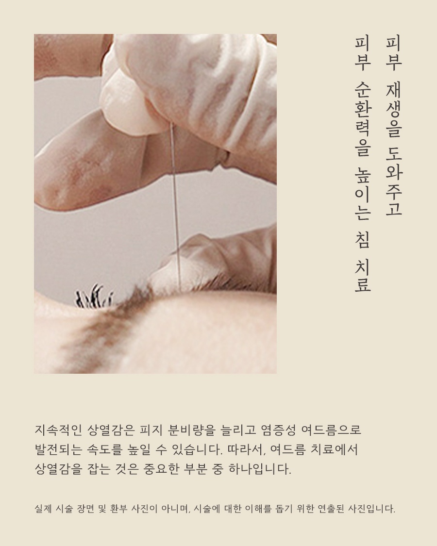 [홍대점] 홍대피부한의원 좁쌀부터 염증성 여드름까지 종류별 특징 설명드립니다 - 해율한의원