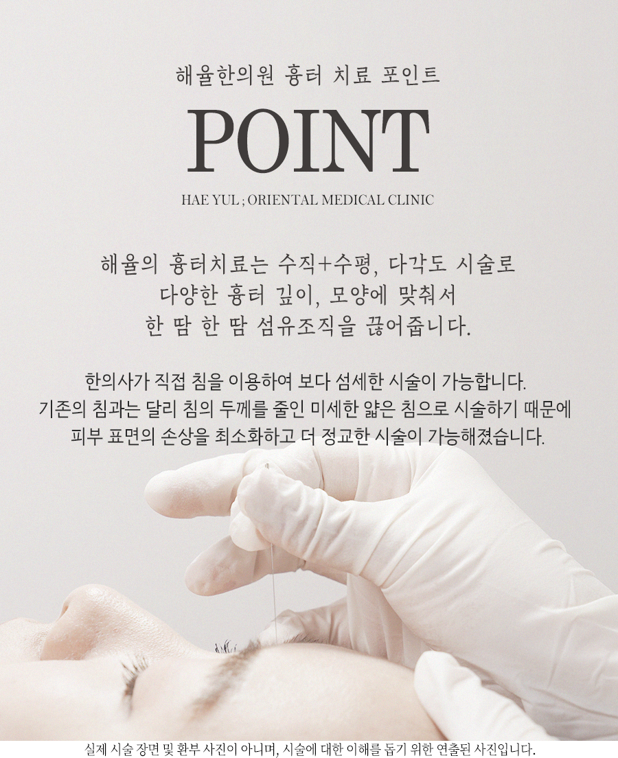 [대구점] 대구새살침 부작용이나 주의사항이 있나요? - 해율한의원