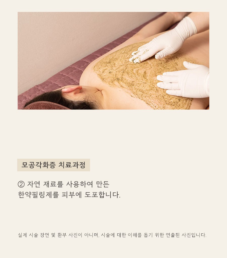 [목동점] 모공각화증 각질 제거로 사라지지 않는 이유, 목동 해율한의원이 설명드립니다 - 해율한의원