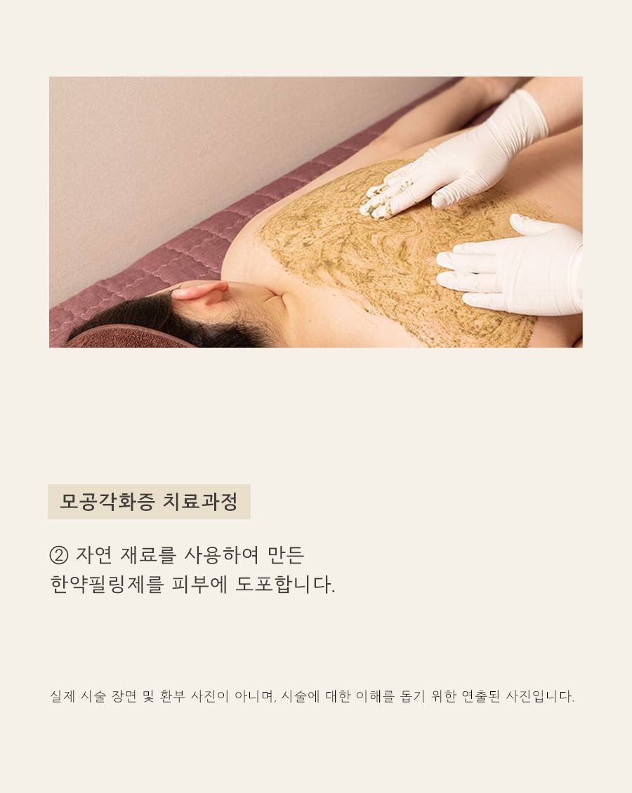 [수원점] 모공각화증 과연 일시적인 현상일까요?수원해율한의원 치료 방법 - 해율한의원