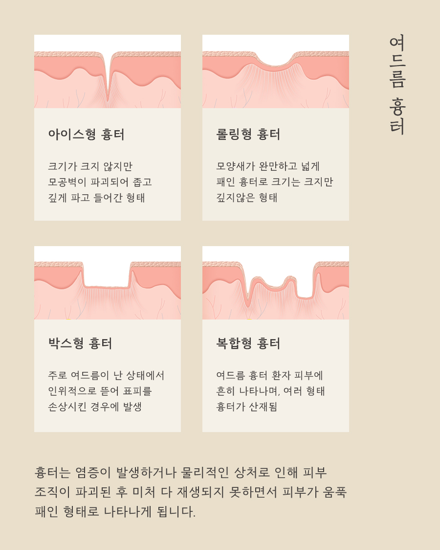 [울산점] 울산피부한의원 입 주변에만 생기는 트러블도 여드름인가요? - 해율한의원
