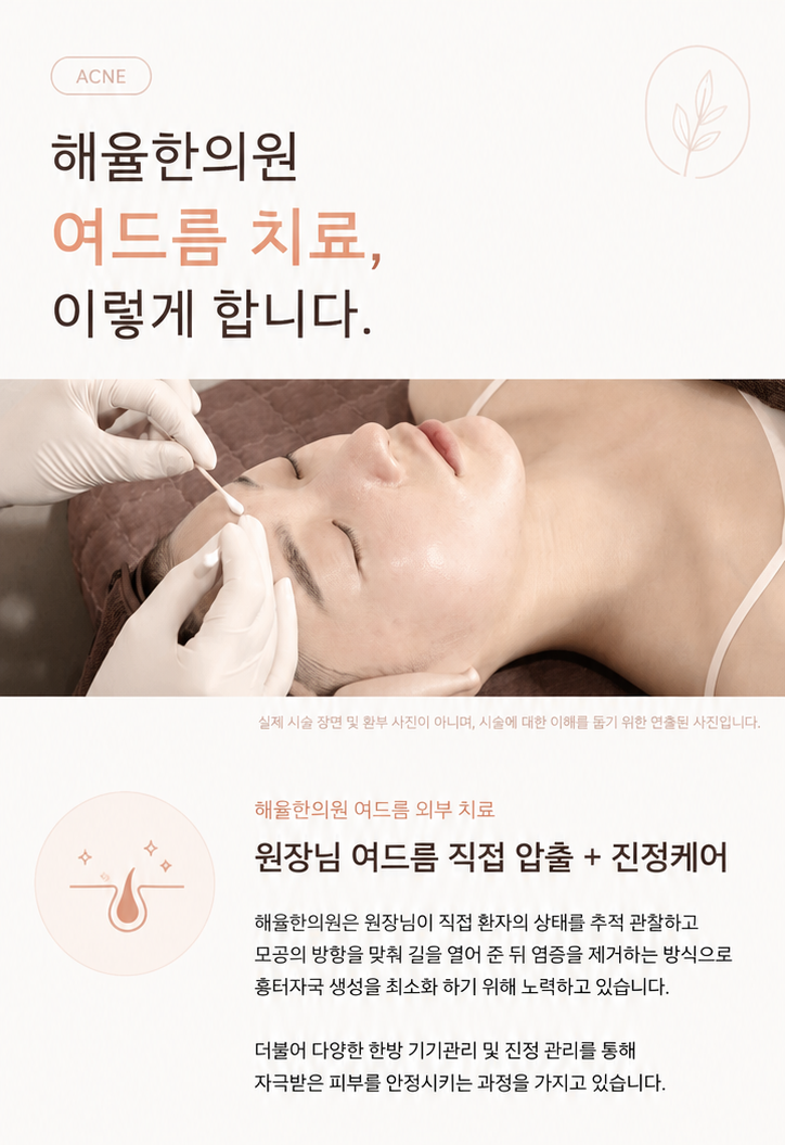 [울산점] 울산여드름피부과 흉터를 예방하는 한의원 치료에 대해 설명드립니다 - 해율한의원
