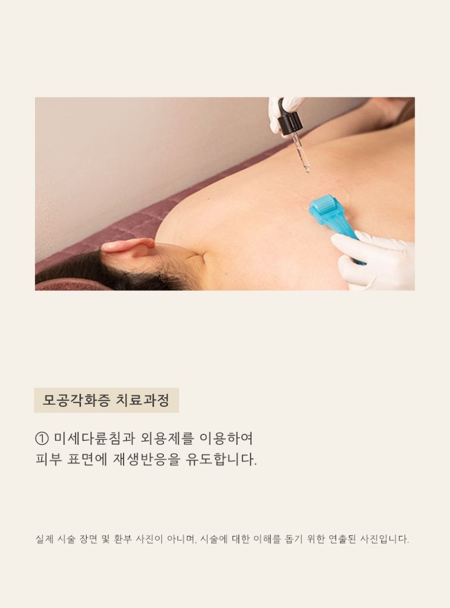 [목동점] 모공각화증 각질 제거로 사라지지 않는 이유, 목동 해율한의원이 설명드립니다 - 해율한의원