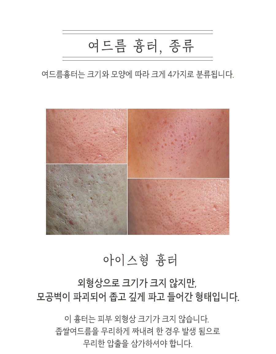 [인천점] 인천새살침 흉터 모양에 따라 치료방법도 달라지나요? - 해율한의원