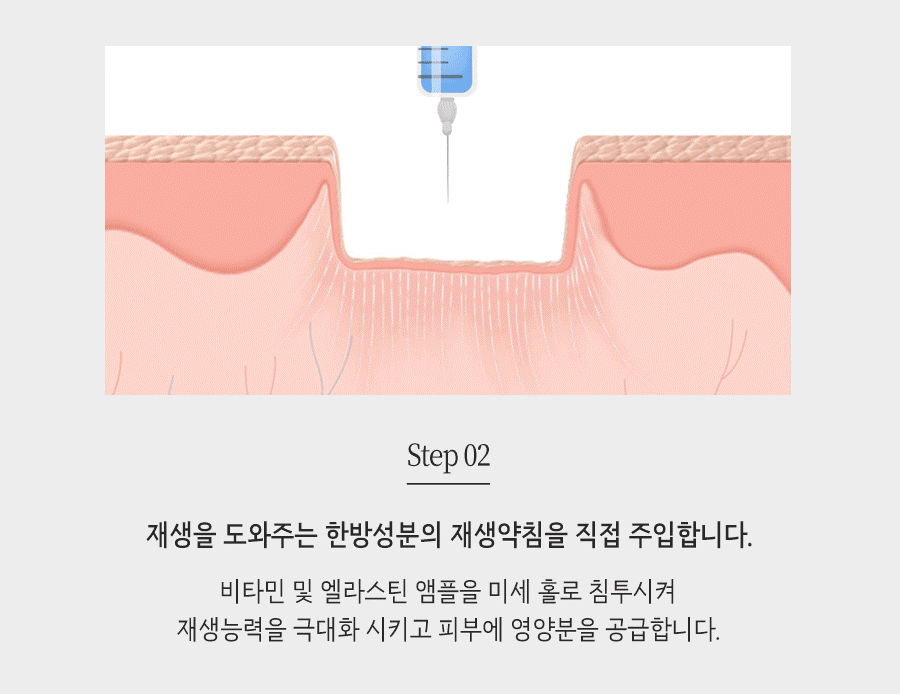 [창원점] 창원여드름흉터 오래된 것도 치료할 수 있을까요? - 해율한의원