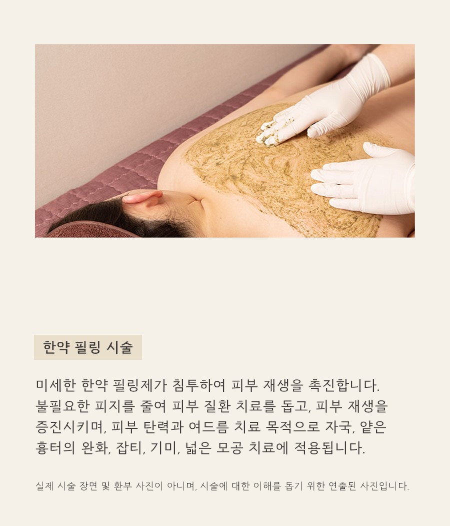 [천안점] 가슴여드름 가드름 색소 침착, 자국 남는 이유는? 천안 해율한의원에서 설명드립니다 - 해율한의원