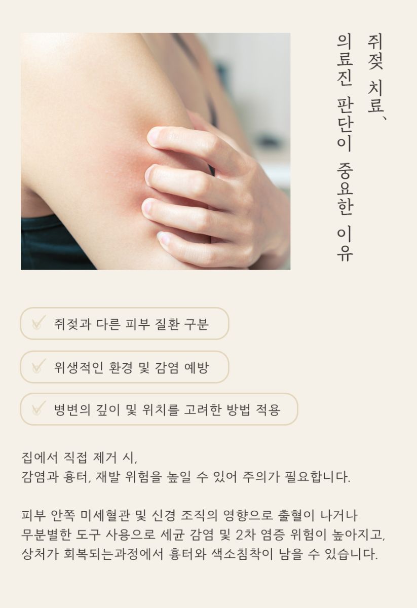 [노원점] 노원쥐젖 집에서 직접 제거해도 괜찮을까요? - 해율한의원