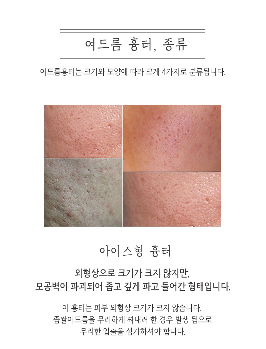 [대구점] 대구새살침 부작용이나 주의사항이 있나요? - 해율한의원