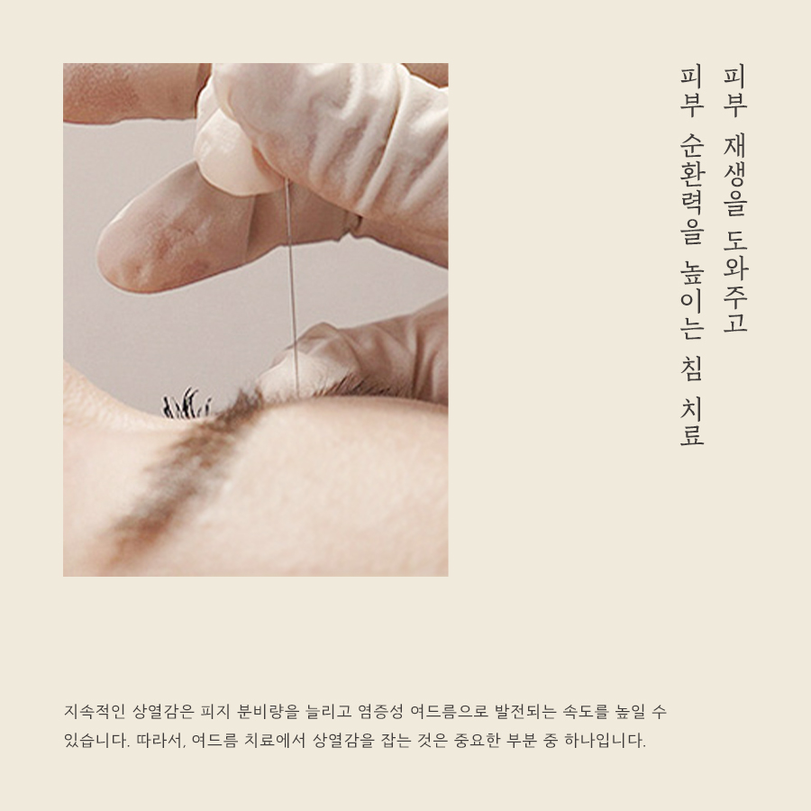 [안양점] 안양여드름한의원 피부 상태에 따라 치료 방법이 달라지나요? - 해율한의원