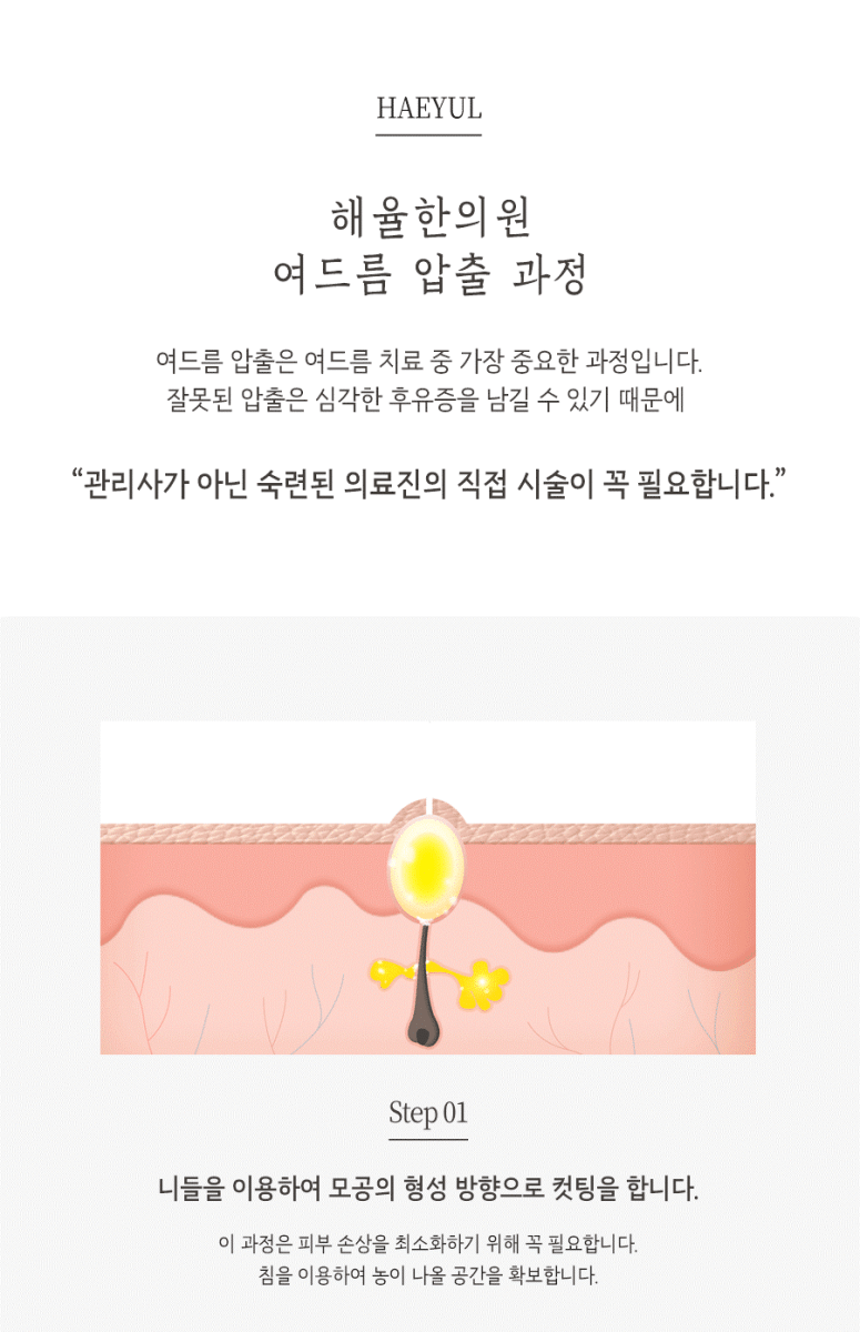[울산점] 울산청소년어린이여드름 치료법과 비용 해율한의원이 설명드립니다. - 해율한의원