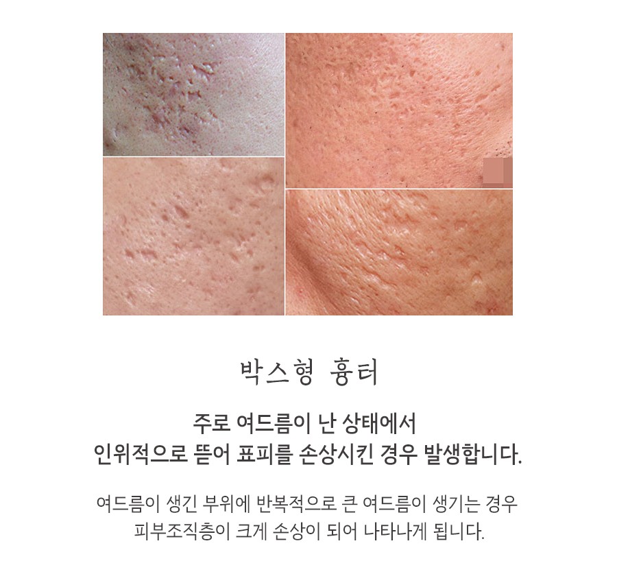 [대구점] 대구새살침 부작용이나 주의사항이 있나요? - 해율한의원