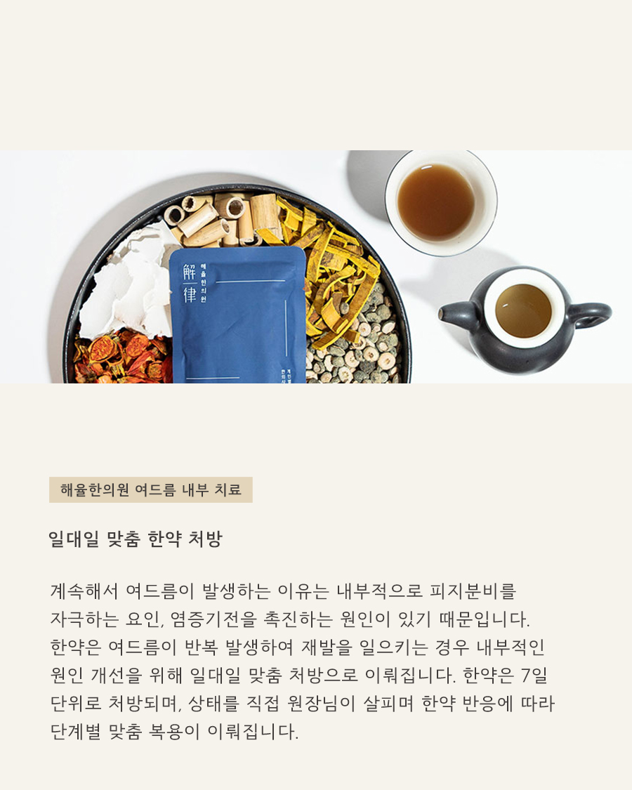 [목동점] 화곡여드름피부과 재발 막는 방법은 무엇일까요? - 해율한의원