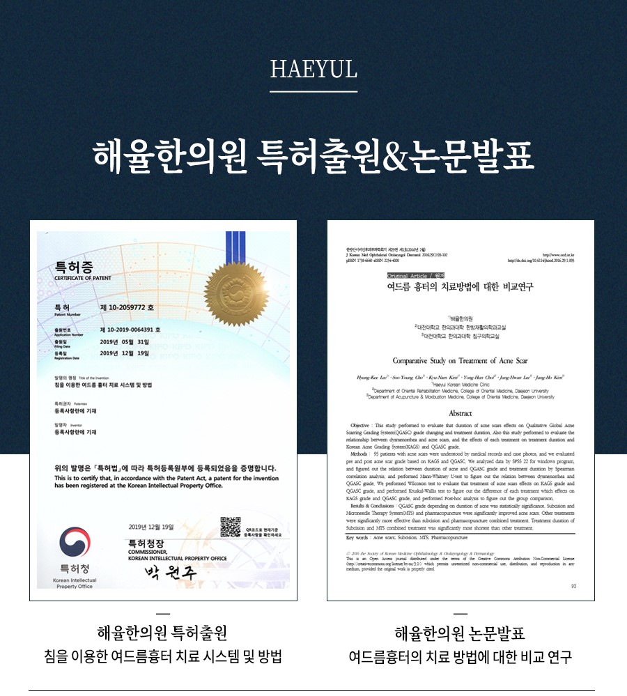 [홍대점] 홍대여드름흉터 오래된 경우에도 치료  가능한가요? - 해율한의원