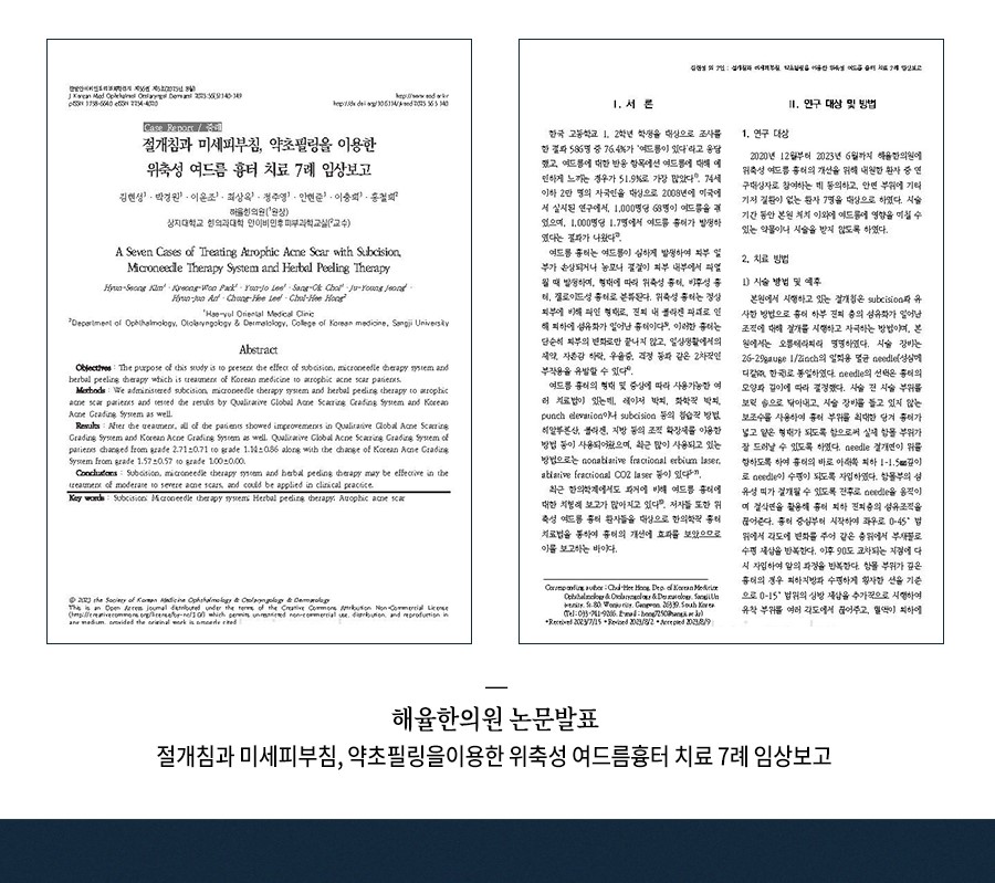 [홍대점] 홍대여드름흉터 오래된 경우에도 치료  가능한가요? - 해율한의원
