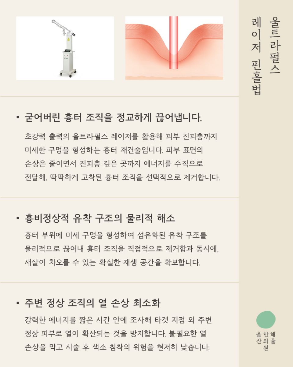 [울산점] 울산해율한의원 여드름흉터, 파인흉터 새살침과 레이저 병행치료법과 비용설명 드립니다. - 해율한의원