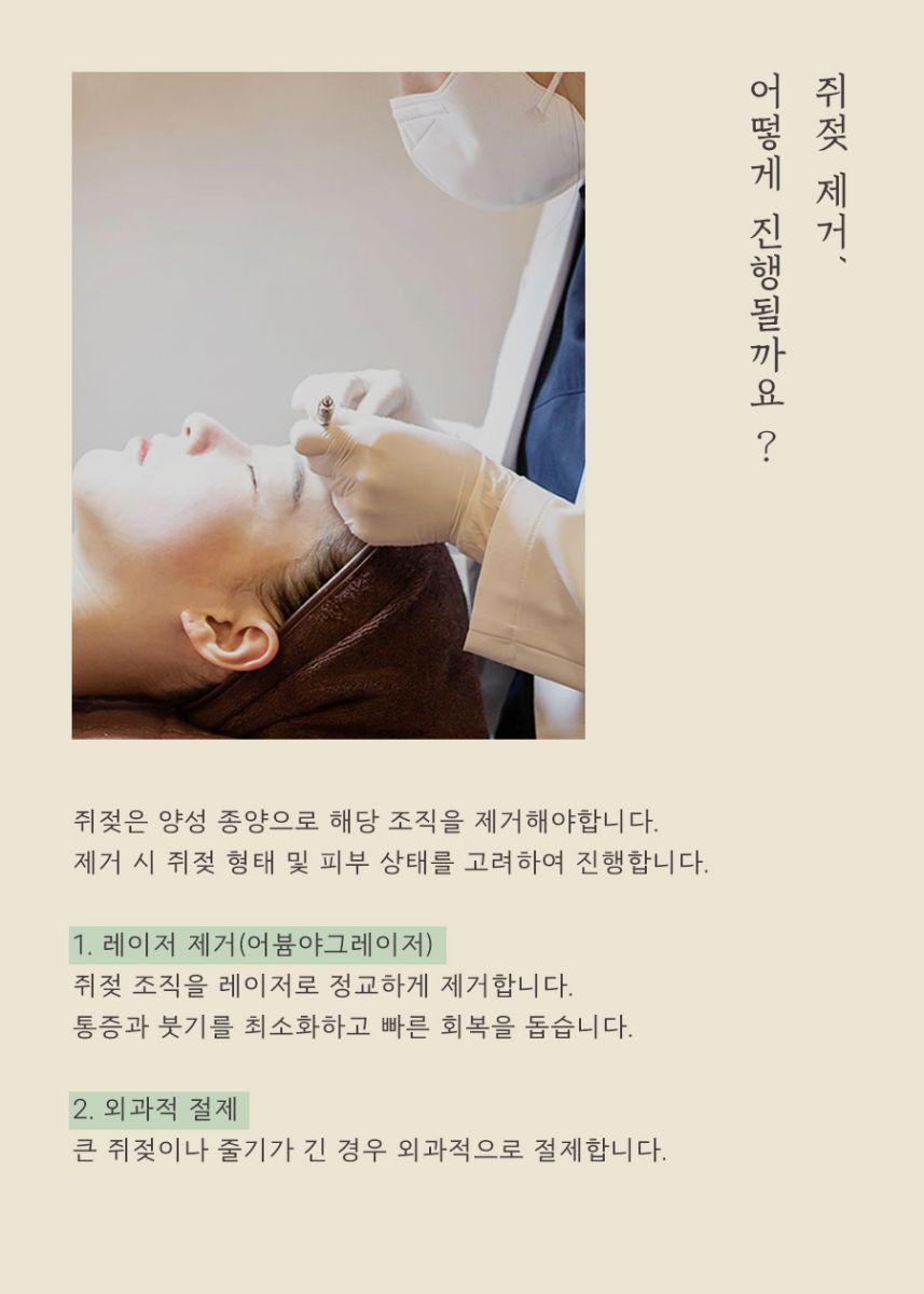 [노원점] 노원쥐젖 집에서 직접 제거해도 괜찮을까요? - 해율한의원