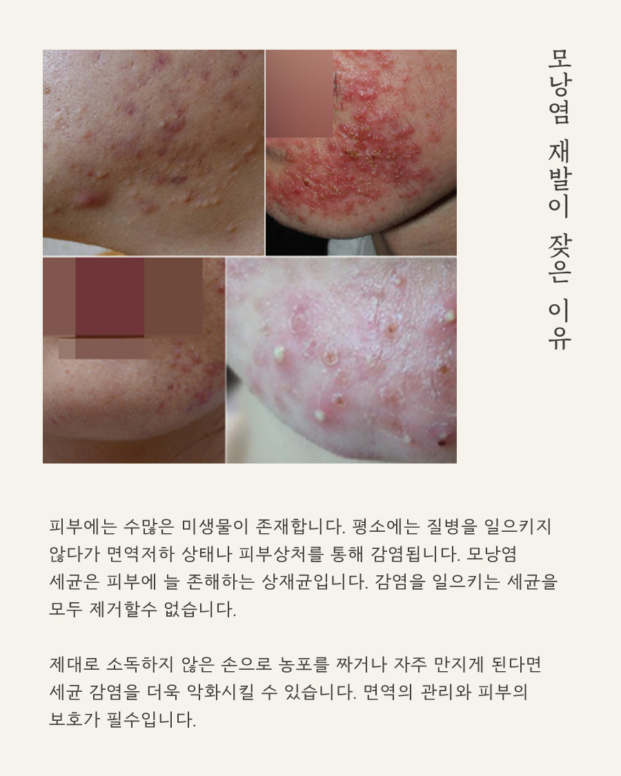 [목동점] 모낭염과 일반 여드름의 차이점 및 주 증상은 무엇인가요 - 해율한의원