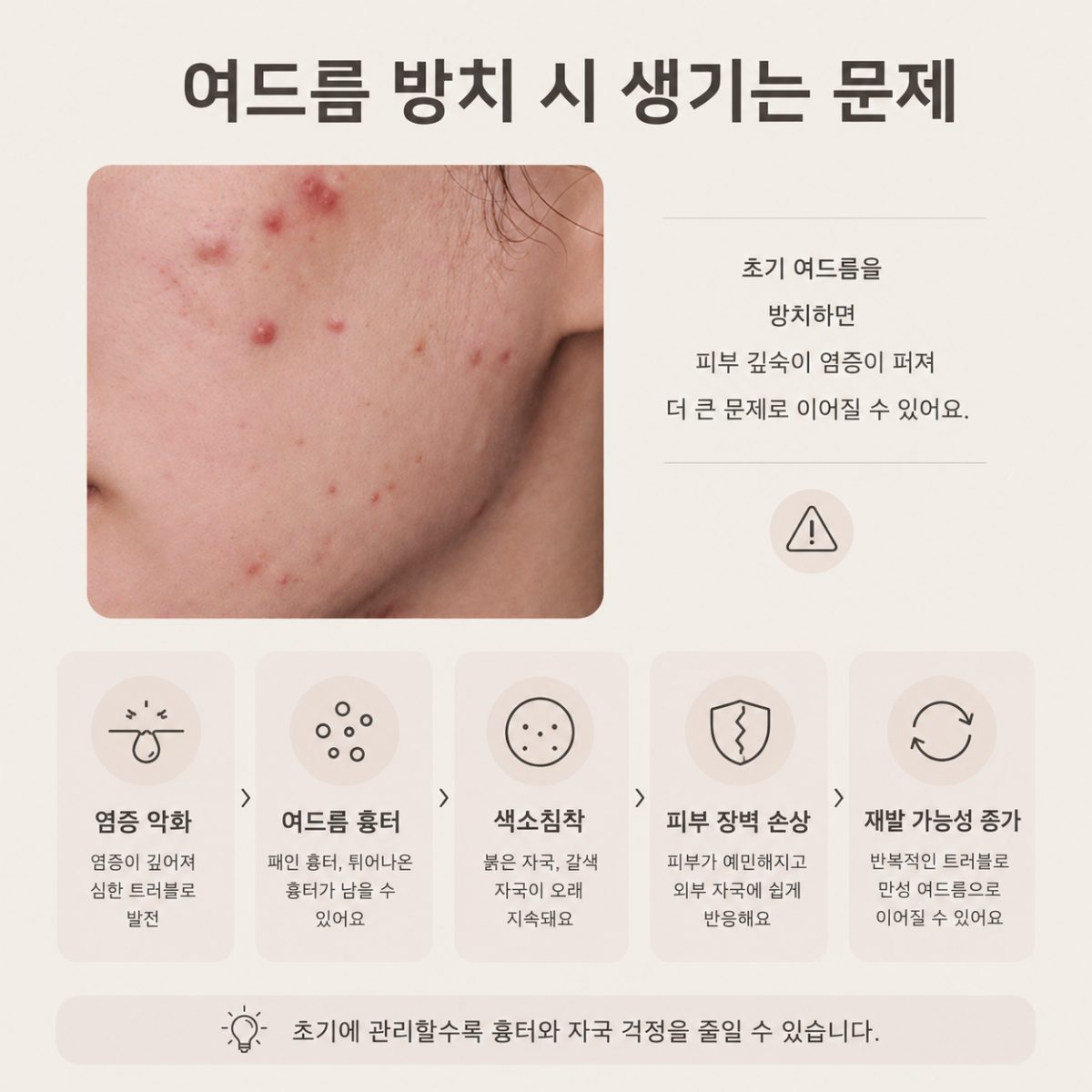 [홍대점] 홍대여드름피부과 화농성 여드름 같은 자리에 반복되는 이유는? - 해율한의원