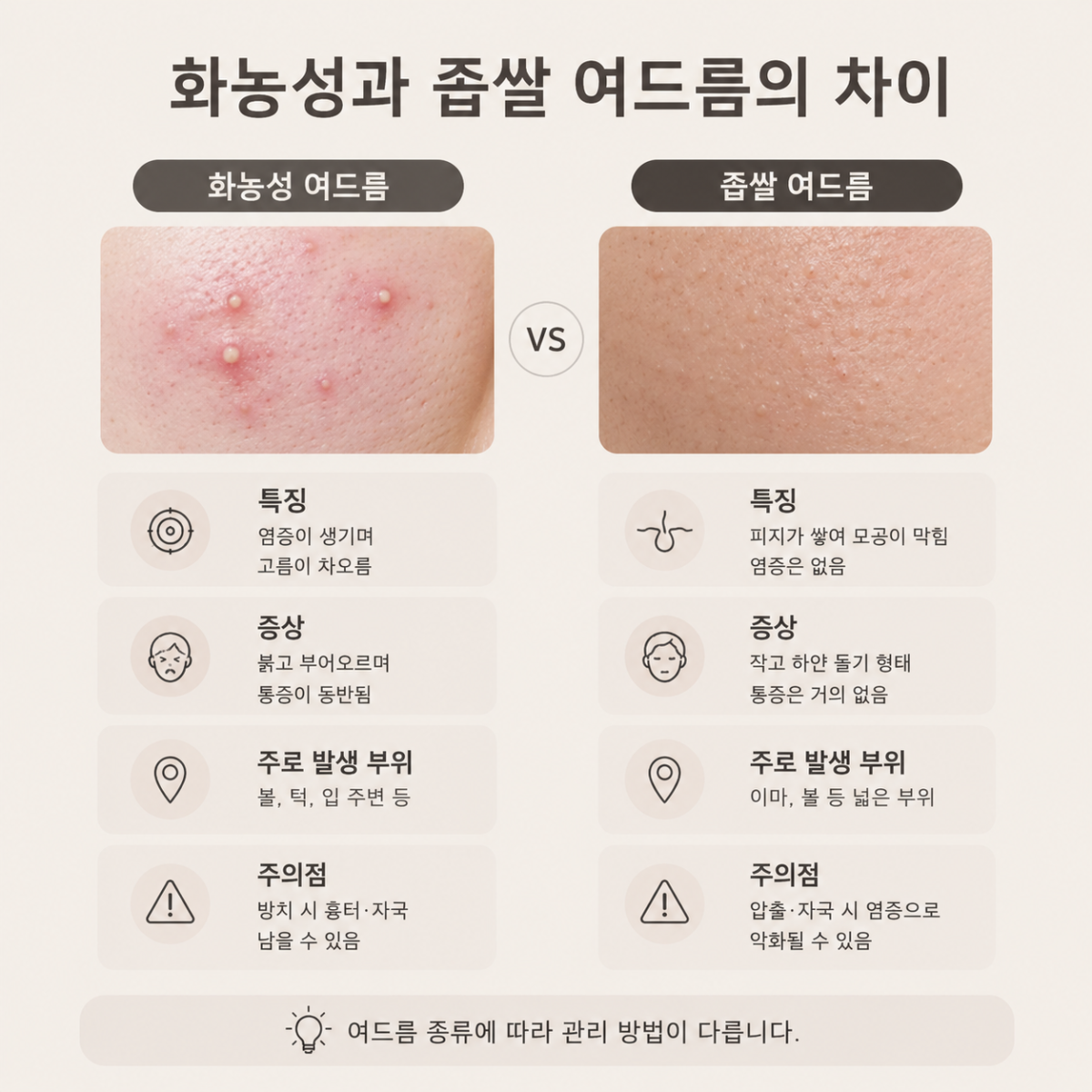 [홍대점] 홍대여드름피부과 화농성 여드름 같은 자리에 반복되는 이유는? - 해율한의원